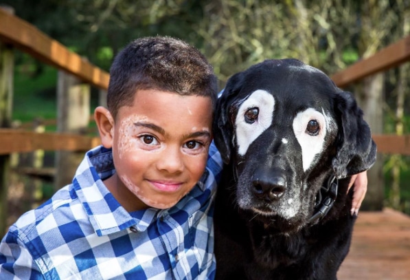 Hond vitiligo